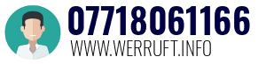 07718061166