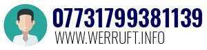 07731799381139